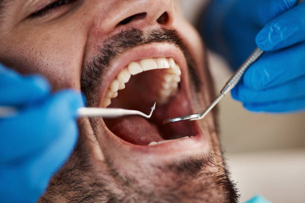 Best Emergency Denture Repair in North Vacherie, LA